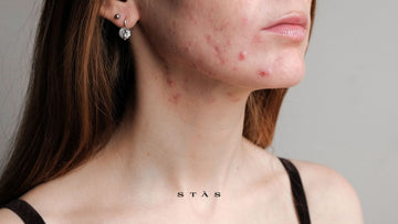 Stress and Skin: What's Actually Happening (And What Actually Helps)